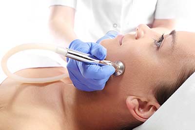 sanfte und schmerzfreie Abtragung der oberen Hautschicht mit Diamant Mikrodermabrasion wird